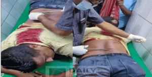 মৌলভীবাজারে সন্ত্রাসীদের অতর্কিত হামলায় সাবেক ছাত্রদল নেতা গুরুতর আহত