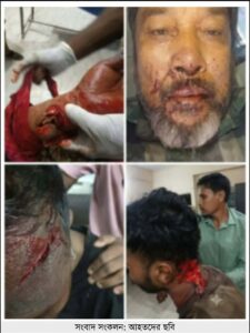 ছাতকে পাওনা টাকাকে কেন্দ্র করে রক্তক্ষয়ী সংঘর্ষ, গুরুতর আহত ৪।