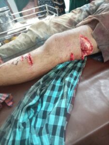 প্রবাসীর মৃত্যুর পরপরই জমি দখলের চেষ্টা: জগন্নাথপুরে সন্ত্রাসী হামলায় যুবক আশঙ্কাজনক, মামলা দায়ের